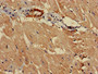 Immunohistochemistry of paraffin-embedded human heart tissue using CAC12823 at dilution of 1:100 Immunohistochemistry of paraffin-embedded human heart tissue using CAC12823 at dilution of 1:100