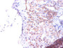 Immunohistochemistry of paraffin-embedded human liver tissue using CAC12824 at dilution of 1:100 Immunohistochemistry of paraffin-embedded human liver tissue using CAC12824 at dilution of 1:100