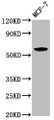 Western Blot, Positive WB detected in: MCF-7 whole cell lysate, All lanes: ILDR1 antibody at 2.6ug/ml, Secondary, Goat polyclonal to rabbit IgG at 1/50000 dilution, Predicted band size: 63, 58, 31, 24, 53, 60 kDa, Observed band size: 63 kDa Western Blot, Positive WB detected in: MCF-7 whole cell lysate, All lanes: ILDR1 antibody at 2.6ug/ml, Secondary, Goat polyclonal to rabbit IgG at 1/50000 dilution, Predicted band size: 63, 58, 31, 24, 53, 60 kDa, Observed band size: 63 kDa