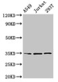 Western Blot, Positive WB detected in: A549 whole cell lysate, Jurkat whole cell lysate, 293T whole cell lysate, All lanes: MAGEA3 antibody at 4ug/ml, Secondary, Goat polyclonal to rabbit IgG at 1/50000 dilution, Predicted band size: 35 kDa, Observed band size: 35 kDa Western Blot, Positive WB detected in: A549 whole cell lysate, Jurkat whole cell lysate, 293T whole cell lysate, All lanes: MAGEA3 antibody at 4ug/ml, Secondary, Goat polyclonal to rabbit IgG at 1/50000 dilution, Predicted band size: 35 kDa, Observed band size: 35 kDa
