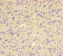 Immunohistochemistry of paraffin-embedded human glioma using CAC12834 at dilution of 1:100 Immunohistochemistry of paraffin-embedded human glioma using CAC12834 at dilution of 1:100