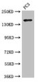 Western Blot, Positive WB detected in: PC-3 whole cell lysate, All lanes: ASTN2 antibody at 3.4ug/ml, Secondary, Goat polyclonal to rabbit IgG at 1/50000 dilution, Predicted band size: 149, 143, 148, 50, 45 kDa, Observed band size: 149 kDa