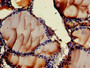 Immunohistochemistry of paraffin-embedded human thyroid tissue using CAC12847 at dilution of 1:100