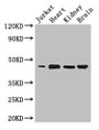 Western Blot, Positive WB detected in: Jurkat whole cell lysate, Mouse heart tissue, Mouse kidney tissue, Mouse brain tissue, All lanes: DOK2 antibody at 3.4ug/ml, Secondary, Goat polyclonal to rabbit IgG at 1/50000 dilution, Predicted band size: 46 kDa, Observed band size: 46 kDa Western Blot, Positive WB detected in: Jurkat whole cell lysate, Mouse heart tissue, Mouse kidney tissue, Mouse brain tissue, All lanes: DOK2 antibody at 3.4ug/ml, Secondary, Goat polyclonal to rabbit IgG at 1/50000 dilution, Predicted band size: 46 kDa, Observed band size: 46 kDa