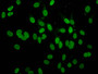 Immunofluorescence staining of Hela cells with CAC12853 at 1:10, counter-stained with DAPI. The cells were fixed in 4% formaldehyde, permeabilized using 0.2% Triton X-100 and blocked in 10% normal Goat Serum. The cells were then incubated with the antibody overnight at 4°C. The secondary antibody was Alexa Fluor 488-congugated AffiniPure Goat Anti-Rabbit IgG(H+L). Immunofluorescence staining of Hela cells with CAC12853 at 1:10, counter-stained with DAPI. The cells were fixed in 4% formaldehyde, permeabilized using 0.2% Triton X-100 and blocked in 10% normal Goat Serum. The cells were then incubated with the antibody overnight at 4°C. The secondary antibody was Alexa Fluor 488-congugated AffiniPure Goat Anti-Rabbit IgG(H+L).
