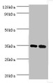 Western Blot, All lanes: MAGEA6 antibody at 7ug/ml, Lane 1: Rat brain tissue, Lane 2: Rat gonad tissue, Secondary, Goat polyclonal to rabbit IgG at 1/10000 dilution, Predicted band size: 35 kDa, Observed band size: 35 kDa Western Blot, All lanes: MAGEA6 antibody at 7ug/ml, Lane 1: Rat brain tissue, Lane 2: Rat gonad tissue, Secondary, Goat polyclonal to rabbit IgG at 1/10000 dilution, Predicted band size: 35 kDa, Observed band size: 35 kDa