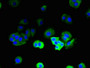 Immunofluorescent analysis of MCF-7 cells using CAC12862 at dilution of 1:100 and Alexa Fluor 488-congugated AffiniPure Goat Anti-Rabbit IgG(H+L) Immunofluorescent analysis of MCF-7 cells using CAC12862 at dilution of 1:100 and Alexa Fluor 488-congugated AffiniPure Goat Anti-Rabbit IgG(H+L)