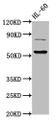 Western Blot, Positive WB detected in: HL60 whole cell lysate, All lanes: KAT5 antibody at 3ug/ml, Secondary, Goat polyclonal to rabbit IgG at 1/50000 dilution, Predicted band size: 59, 54, 62, 57 kDa, Observed band size: 59 kDa Western Blot, Positive WB detected in: HL60 whole cell lysate, All lanes: KAT5 antibody at 3ug/ml, Secondary, Goat polyclonal to rabbit IgG at 1/50000 dilution, Predicted band size: 59, 54, 62, 57 kDa, Observed band size: 59 kDa