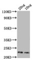 Western Blot, Positive WB detected in: recombinant protein, All lanes: Major mite allergen Der p 23 Antibody at 1:1000, Secondary, Goat polyclonal to rabbit IgG at 1/50000 dilution, Predicted band size: 20 kDa, Observed band size: 23 kDa Western Blot, Positive WB detected in: recombinant protein, All lanes: Major mite allergen Der p 23 Antibody at 1:1000, Secondary, Goat polyclonal to rabbit IgG at 1/50000 dilution, Predicted band size: 20 kDa, Observed band size: 23 kDa