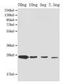 Western Blot, Positive WB detected in Recombinant protein, All lanes: ompX antibody at 1:2000, Secondary, Goat polyclonal to rabbit IgG at 1/50000 dilution, Predicted band size: 27 kDa, Observed band size: 27 kDa Western Blot, Positive WB detected in Recombinant protein, All lanes: ompX antibody at 1:2000, Secondary, Goat polyclonal to rabbit IgG at 1/50000 dilution, Predicted band size: 27 kDa, Observed band size: 27 kDa