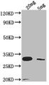 Western Blot, Positive WB detected in Recombinant protein, All lanes: LAMB antibody at 1:2000, Secondary, Goat polyclonal to rabbit IgG at 1/50000 dilution, Predicted band size: 29.8 kDa, Observed band size: 31 kDa Western Blot, Positive WB detected in Recombinant protein, All lanes: LAMB antibody at 1:2000, Secondary, Goat polyclonal to rabbit IgG at 1/50000 dilution, Predicted band size: 29.8 kDa, Observed band size: 31 kDa