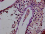 IHC image of CAC12880 diluted at 1:400 and staining in paraffin-embedded human testis tissue performed on a Leica BondTM system. After dewaxing and hydration, antigen retrieval was mediated by high pressure in a citrate buffer (pH 6.0). Section was blocked with 10% normal goat serum 30min at RT. Then primary antibody (1% BSA) was incubated at 4°C overnight. The primary is detected by a biotinylated secondary antibody and visualized using an HRP conjugated SP system. IHC image of CAC12880 diluted at 1:400 and staining in paraffin-embedded human testis tissue performed on a Leica BondTM system. After dewaxing and hydration, antigen retrieval was mediated by high pressure in a citrate buffer (pH 6.0). Section was blocked with 10% normal goat serum 30min at RT. Then primary antibody (1% BSA) was incubated at 4°C overnight. The primary is detected by a biotinylated secondary antibody and visualized using an HRP conjugated SP system.