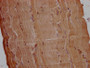 IHC image of CAC12882 diluted at 1:200 and staining in paraffin-embedded human skeletal muscle tissue performed on a Leica BondTM system. After dewaxing and hydration, antigen retrieval was mediated by high pressure in a citrate buffer (pH 6.0). Section was blocked with 10% normal goat serum 30min at RT. Then primary antibody (1% BSA) was incubated at 4°C overnight. The primary is detected by a Goat anti-rabbit polymer IgG labeled by HRP and visualized using 0.05% DAB. IHC image of CAC12882 diluted at 1:200 and staining in paraffin-embedded human skeletal muscle tissue performed on a Leica BondTM system. After dewaxing and hydration, antigen retrieval was mediated by high pressure in a citrate buffer (pH 6.0). Section was blocked with 10% normal goat serum 30min at RT. Then primary antibody (1% BSA) was incubated at 4°C overnight. The primary is detected by a Goat anti-rabbit polymer IgG labeled by HRP and visualized using 0.05% DAB.