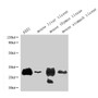 Western BlotPositive WB detected in: A431 whole cell lysate, Mouse liver tissue, Mouse thymus tissue, Mouse stomach tissueAll lanes: RTP4 antibody at 1:1000SecondaryGoat polyclonal to rabbit IgG at 1/50000 dilutionPredicted band size: 28 kDaObserved band size: 28 kDa Western BlotPositive WB detected in: A431 whole cell lysate, Mouse liver tissue, Mouse thymus tissue, Mouse stomach tissueAll lanes: RTP4 antibody at 1:1000SecondaryGoat polyclonal to rabbit IgG at 1/50000 dilutionPredicted band size: 28 kDaObserved band size: 28 kDa