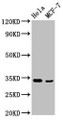 Western Blot, Positive WB detected in: Hela whole cell lysate, MCF-7 whole cell lysate, All lanes: NFKBID antibody at 3.4ug/ml, Secondary, Goat polyclonal to rabbit IgG at 1/50000 dilution, Predicted band size: 34, 51, 16 kDa, Observed band size: 34 kDa