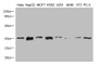 Western Blot Positive WB detected in: CYC1 antibody at 1:1000 Lane 1: Hela whole cell lysate Lane 2: HepG2 whole cell lysate Lane 3: MCF-7 whole cell lysate Lane 4: K562 whole cell lysate Lane 5: U251 whole cell lysate Lane 6: A549 whole cell lysate Lane 7: NIH/3T3 whole cell lysate Lane 8: PC-3 whole cell lysateSecondary Goat polyclonal to Mouse IgG at 1/20000 dilution Predicted band size: 35 KDa Observed band size: 35 KDa Exposure time: 5min
