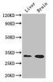 Western Blot, Positive WB detected in: Mouse liver tissue, Mouse brain tissue, All lanes: CD37 antibody at 2.7ug/ml, Secondary, Goat polyclonal to rabbit IgG at 1/50000 dilution, Predicted band size: 32, 24, 23 kDa, Observed band size: 32 kDa Western Blot, Positive WB detected in: Mouse liver tissue, Mouse brain tissue, All lanes: CD37 antibody at 2.7ug/ml, Secondary, Goat polyclonal to rabbit IgG at 1/50000 dilution, Predicted band size: 32, 24, 23 kDa, Observed band size: 32 kDa