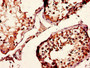 Immunohistochemistry of paraffin-embedded human testis tissue using CAC12896 at dilution of 1:100 Immunohistochemistry of paraffin-embedded human testis tissue using CAC12896 at dilution of 1:100