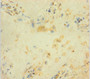 Immunohistochemistry of paraffin-embedded human placenta tissue using CAC12901 at dilution of 1:100 Immunohistochemistry of paraffin-embedded human placenta tissue using CAC12901 at dilution of 1:100