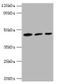 Western Blot, All lanes: IDH1 antibody at 3ug/ml, Lane 1: Mouse liver tissue, Lane 2: Hela whole cell lysate, Lane 3: NIH/3T3 whloe cell lysate, Secondary, Goat polyclonal to rabbit at 1/10000 dilution, Predicted band size: 47 kDa, Observed band size: 47 kDa