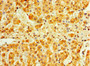 Immunohistochemistry of paraffin-embedded human adrenal gland tissue using CAC12906 at dilution of 1:100