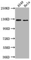 Western Blot, Positive WB detected in: A549 whole cell lysate, Hela whole cell lysate, All lanes: IGSF3 antibody at 1:2000, Secondary, Goat polyclonal to rabbit IgG at 1/50000 dilution, Predicted band size: 136, 138 kDa, Observed band size: 125 kDa