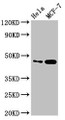Western Blot, Positive WB detected in: Hela whole cell lysate, MCF-7 whole cell lysate, All lanes: INSIG1 antibody at 2.8ug/ml, Secondary, Goat polyclonal to rabbit IgG at 1/50000 dilution, Predicted band size: 30, 18 kDa, Observed band size: 46 kDa Western Blot, Positive WB detected in: Hela whole cell lysate, MCF-7 whole cell lysate, All lanes: INSIG1 antibody at 2.8ug/ml, Secondary, Goat polyclonal to rabbit IgG at 1/50000 dilution, Predicted band size: 30, 18 kDa, Observed band size: 46 kDa