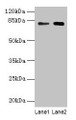 Western Blot, All lanes: MASP1 antibody at 6ug/ml, Lane 1: Hela whole cell lysate, Lane 2: U251 whole cell lysate, Secondary, Goat polyclonal to rabbit IgG at 1/10000 dilution, Predicted band size: 80, 82, 44, 69 kDa, Observed band size: 80 kDa
