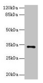 Western Blot, All lanes: NAT2 antibody at 6ug/ml + Mouse brain tissue, Secondary, Goat polyclonal to rabbit IgG at 1/10000 dilution, Predicted band size: 34 kDa, Observed band size: 34 kDa