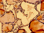 Immunohistochemistry of paraffin-embedded human thyroid tissue using CAC12913 at dilution of 1:100