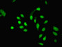 Immunofluorescent analysis of Hela cells using CAC12915 at dilution of 1:100 and Alexa Fluor 488-congugated AffiniPure Goat Anti-Rabbit IgG(H+L) Immunofluorescent analysis of Hela cells using CAC12915 at dilution of 1:100 and Alexa Fluor 488-congugated AffiniPure Goat Anti-Rabbit IgG(H+L)