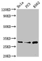 Western Blot, Positive WB detected in: Hela whole cell lysate, PC-3 whole cell lysate, K562 whole cell lysate, All lanes: PSMA1 antibody at 3.4ug/ml, Secondary, Goat polyclonal to rabbit IgG at 1/50000 dilution, Predicted band size: 30, 31 kDa, Observed band size: 30 kDa