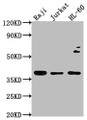 Western Blot, Positive WB detected in: Raji whole cell lysate, Jurkat whole cell lysate, HL-60 whole cell lysate, All lanes: RASSF2 antibody at 1:2000, Secondary, Goat polyclonal to rabbit IgG at 1/50000 dilution, Predicted band size: 38, 18 kDa, Observed band size: 38 kDa