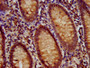 IHC image of CAC12921 diluted at 1:700 and staining in paraffin-embedded human appendix tissue performed on a Leica BondTM system. After dewaxing and hydration, antigen retrieval was mediated by high pressure in a citrate buffer (pH 6.0). Section was blocked with 10% normal goat serum 30min at RT. Then primary antibody (1% BSA) was incubated at 4°C overnight. The primary is detected by a biotinylated secondary antibody and visualized using an HRP conjugated SP system.