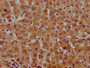 IHC image of CAC12923 diluted at 1:600 and staining in paraffin-embedded human liver tissue performed on a Leica BondTM system. After dewaxing and hydration, antigen retrieval was mediated by high pressure in a citrate buffer (pH 6.0). Section was blocked with 10% normal goat serum 30min at RT. Then primary antibody (1% BSA) was incubated at 4°C overnight. The primary is detected by a biotinylated secondary antibody and visualized using an HRP conjugated SP system.