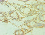 Immunohistochemistry of paraffin-embedded human colon tissue using CAC12924 at dilution of 1:100 Immunohistochemistry of paraffin-embedded human colon tissue using CAC12924 at dilution of 1:100