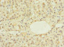 Immunohistochemistry of paraffin-embedded human adrenal gland tissue using CAC12928 at dilution of 1:100