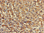 Immunohistochemistry of paraffin-embedded human adrenal gland tissue using CAC12930 at dilution of 1:100