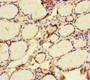 Immunohistochemistry of paraffin-embedded human thyroid tissue using CAC12931 at dilution of 1:100