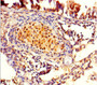 Immunohistochemistry of paraffin-embedded human lung tissue using CAC12934 at dilution of 1:100 Immunohistochemistry of paraffin-embedded human lung tissue using CAC12934 at dilution of 1:100