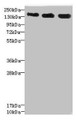 Western Blot, All lanes: ANKS1B antibody at 5.28ug/ml, Lane 1: 293T whole cell lysate, Lane 2: HepG2 whole cell lysate, Lane 3: Hela whole cell lysate, Secondary, Goat polyclonal to rabbit IgG at 1/10000 dilution, Predicted band size: 139, 49, 58, 53, 52, 86, 48, 41, 29, 45 kDa, Observed band size: 139 kDa Western Blot, All lanes: ANKS1B antibody at 5.28ug/ml, Lane 1: 293T whole cell lysate, Lane 2: HepG2 whole cell lysate, Lane 3: Hela whole cell lysate, Secondary, Goat polyclonal to rabbit IgG at 1/10000 dilution, Predicted band size: 139, 49, 58, 53, 52, 86, 48, 41, 29, 45 kDa, Observed band size: 139 kDa