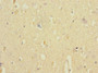 Immunohistochemistry of paraffin-embedded human brain tissue using CAC12941 at dilution of 1:100 Immunohistochemistry of paraffin-embedded human brain tissue using CAC12941 at dilution of 1:100