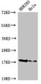 Western Blot, Positive WB detected in: HEK293 whole cell lysate, Hela whole cell lysate, All lanes: RNASEH2C antibody at 3ug/ml, Secondary, Goat polyclonal to rabbit IgG at 1/50000 dilution, Predicted band size: 18 kDa, Observed band size: 18 kDa Western Blot, Positive WB detected in: HEK293 whole cell lysate, Hela whole cell lysate, All lanes: RNASEH2C antibody at 3ug/ml, Secondary, Goat polyclonal to rabbit IgG at 1/50000 dilution, Predicted band size: 18 kDa, Observed band size: 18 kDa