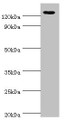 Western Blot, All lanes: NLRP2 antibody at 12ug/ml + A431 whole cell lysate, Secondary, Goat polyclonal to rabbit IgG at 1/10000 dilution, Predicted band size: 121, 119, 97, 118 kDa, Observed band size: 121 kDa Western Blot, All lanes: NLRP2 antibody at 12ug/ml + A431 whole cell lysate, Secondary, Goat polyclonal to rabbit IgG at 1/10000 dilution, Predicted band size: 121, 119, 97, 118 kDa, Observed band size: 121 kDa