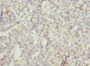 Immunohistochemistry of paraffin-embedded human pancreatic tissue using CAC12959 at dilution of 1:100 Immunohistochemistry of paraffin-embedded human pancreatic tissue using CAC12959 at dilution of 1:100