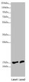 Western Blot, All lanes: NDUFA12 antibody at 3.71ug/ml, Lane 1: HepG2 whole cell lysate, Lane 2: 293T whole cell lysate, Secondary, Goat polyclonal to rabbit IgG at 1/10000 dilution, Predicted band size: 18, 8 kDa, Observed band size: 18 kDa Western Blot, All lanes: NDUFA12 antibody at 3.71ug/ml, Lane 1: HepG2 whole cell lysate, Lane 2: 293T whole cell lysate, Secondary, Goat polyclonal to rabbit IgG at 1/10000 dilution, Predicted band size: 18, 8 kDa, Observed band size: 18 kDa