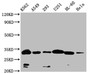 Western Blot, Positive WB detected in: K562 whole cell lysate,A549 whole cell lysate,293 whole cell lysate,U251 whole cell lysate,HL-60 whole cell lysate,Hela whole cell lysate, All lanes: VDAC3 antibody at 1:1000, Secondary, Goat polyclonal to rabbit IgG at 1/50000 dilution, Predicted band size: 31 kDa, Observed band size: 32 kDa