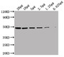 Western Blot, Positive WB detected in: HepG2 whole cell lysate at 20ug, 10ug, 5ug, 2.5ug, 1.25ug, 0.625ug, All lanes: ENO1 antibody at 1:5000, Secondary, Goat polyclonal to Mouse IgG at 1/10000 dilution, Predicted band size: 47 kDa, Observed band size: 47 KDa, Exposure time: 10s Western Blot, Positive WB detected in: HepG2 whole cell lysate at 20ug, 10ug, 5ug, 2.5ug, 1.25ug, 0.625ug, All lanes: ENO1 antibody at 1:5000, Secondary, Goat polyclonal to Mouse IgG at 1/10000 dilution, Predicted band size: 47 kDa, Observed band size: 47 KDa, Exposure time: 10s