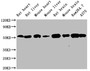 Western Blot Positive WB detected in: Rat heart tissue ,Rat liver tissue, Mouse heart tissue, Mouse liver tissue, Rat brain tissue, Mouse brain tissue, Raw264.7 whole cell lysate, A375 whole cell lysate All lanes TUBB antibody at 1:5000 Secondary Goat polyclonal to mouse IgG at 1/50000 dilution Predicted band size: 55 KDa Observed band size: 55 KDa Exposure time:5min Western Blot Positive WB detected in: Rat heart tissue ,Rat liver tissue, Mouse heart tissue, Mouse liver tissue, Rat brain tissue, Mouse brain tissue, Raw264.7 whole cell lysate, A375 whole cell lysate All lanes TUBB antibody at 1:5000 Secondary Goat polyclonal to mouse IgG at 1/50000 dilution Predicted band size: 55 KDa Observed band size: 55 KDa Exposure time:5min