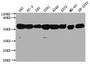 Western Blot, Positive WB detected in: U87 whole cell lysate, PC-3 whole cell lysate, 293 whole cell lysate, U251 whole cell lysate, A549 whole cell lysate, A375 whole cell lysate, MG-63 whole cell lysate, SH-SY5Y whole cell lysate, , All lanes: TUBA1A antibody at 1:5000, Secondary, Goat polyclonal to Mouse IgG at 1/10000 dilution, Predicted band size: 52 kDa, Observed band size: 52 kDa Western Blot, Positive WB detected in: U87 whole cell lysate, PC-3 whole cell lysate, 293 whole cell lysate, U251 whole cell lysate, A549 whole cell lysate, A375 whole cell lysate, MG-63 whole cell lysate, SH-SY5Y whole cell lysate, , All lanes: TUBA1A antibody at 1:5000, Secondary, Goat polyclonal to Mouse IgG at 1/10000 dilution, Predicted band size: 52 kDa, Observed band size: 52 kDa